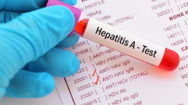 Numărul infecţiilor cu hepatită virală A a explodat la Constanța