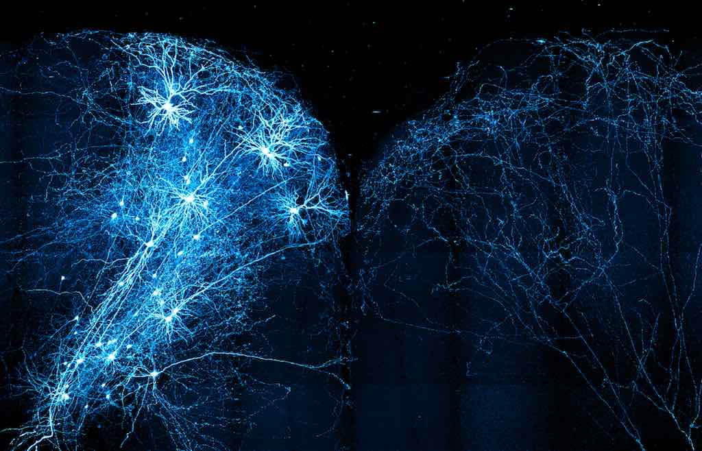 Au fost creați neuronii artificiali care pot repara circuitele nervoase din creier