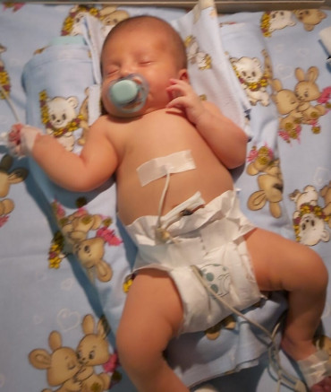 Și tu poți salva inima micuței Adela! Are doar două săptămâni și malformații cardiace grave