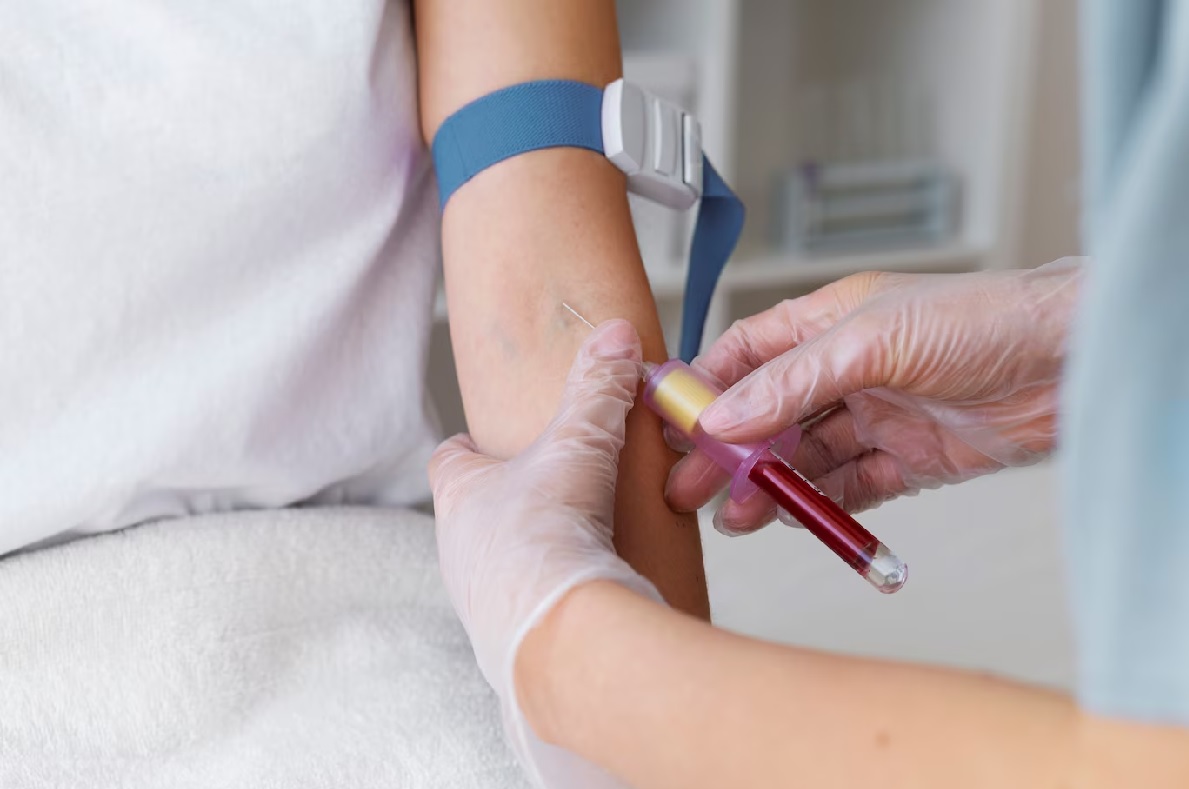 Casa de Asigurări de Sănătate va ELIMINA, în 2026, plafoanele de la laboratoarele de analize medicale