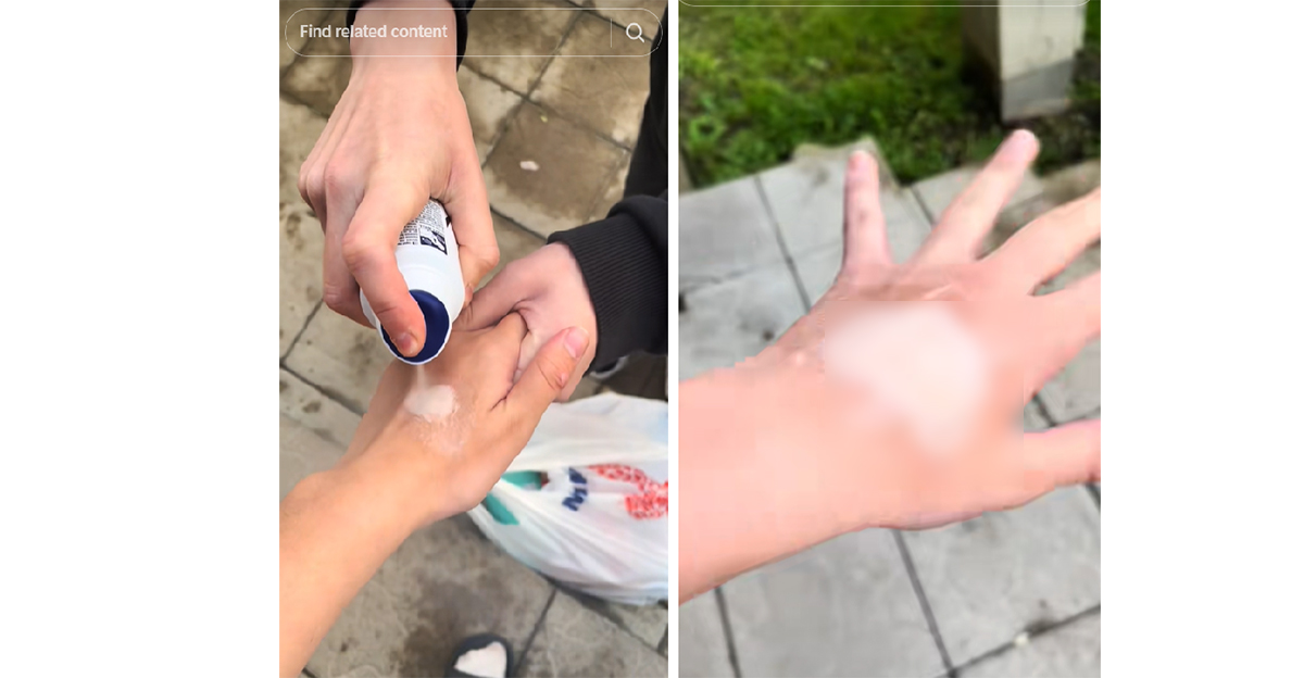 Trend PERICULOS pe TikTok: Provocarea deodorantului vă poate lăsa semne pe piele pentru toată viața